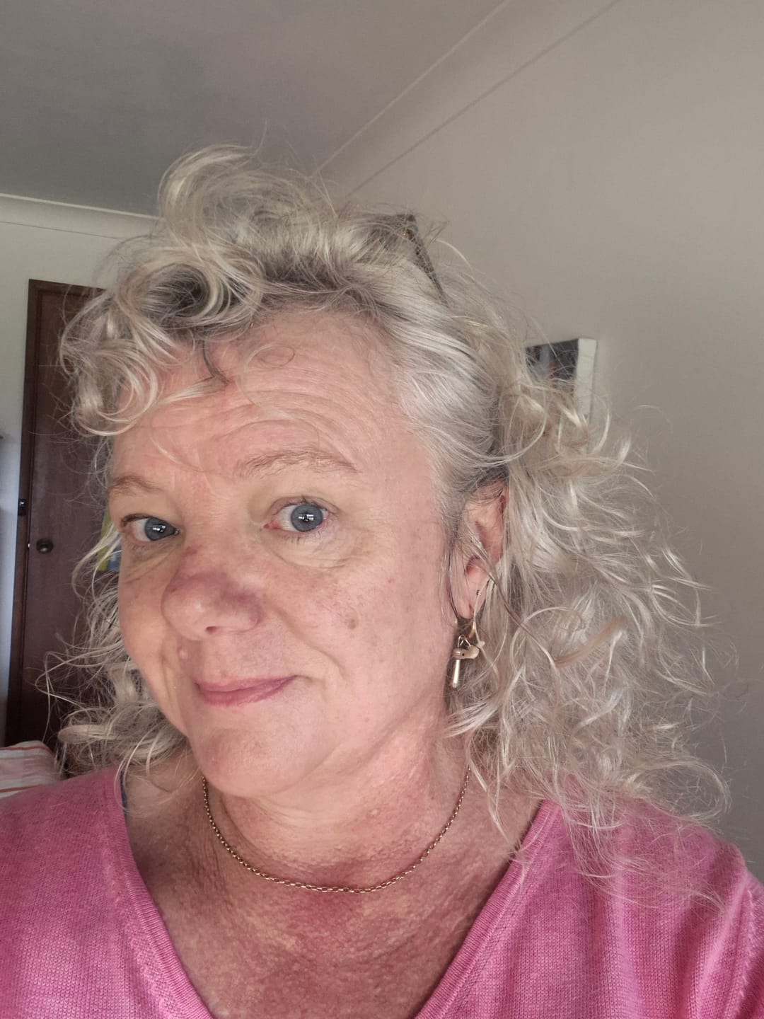Customer photo review of The Magic Hair Cream