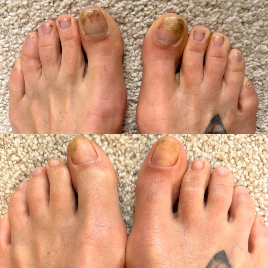 Customer photo review of Fungal Freedom