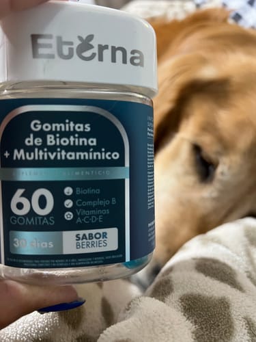 Customer photo review of Gomitas de Biotina y Multivitamínico | Suscripción