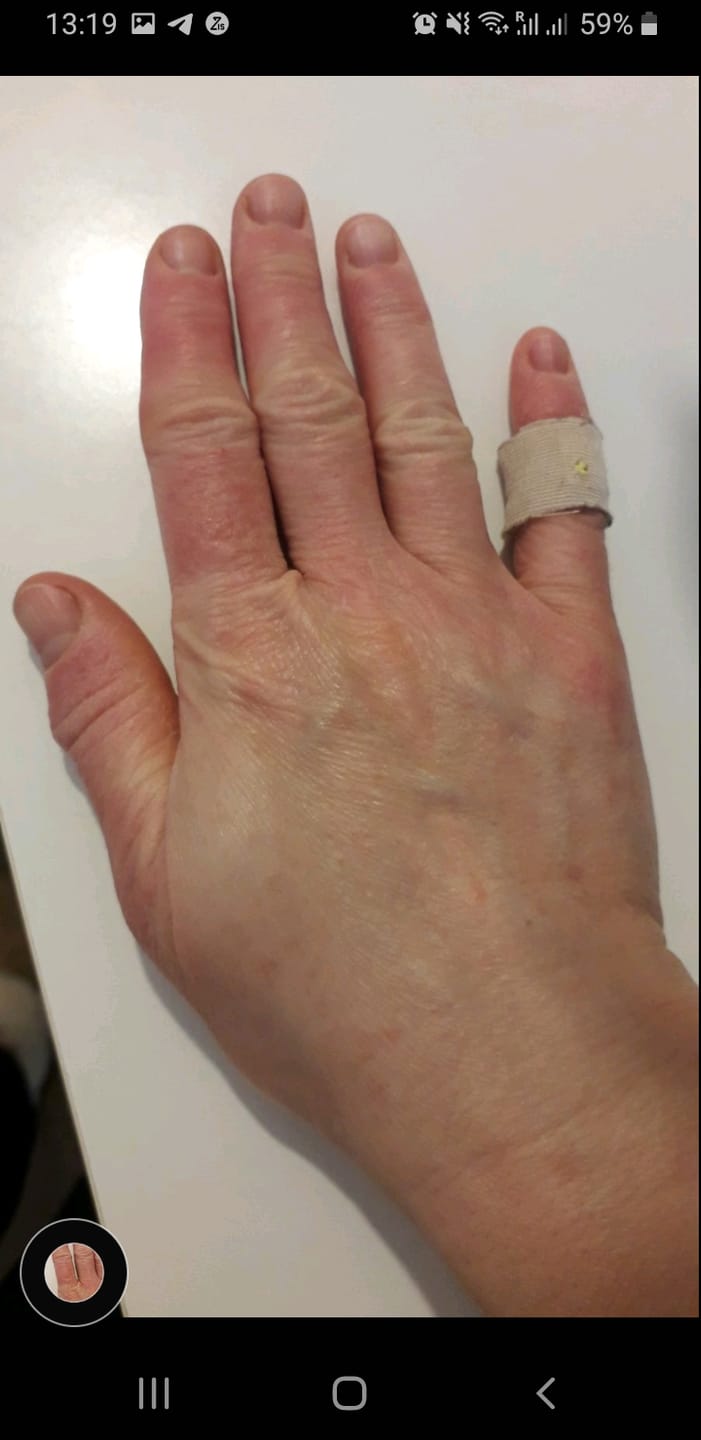 Customer photo review of Large Bioskin Duo Pack