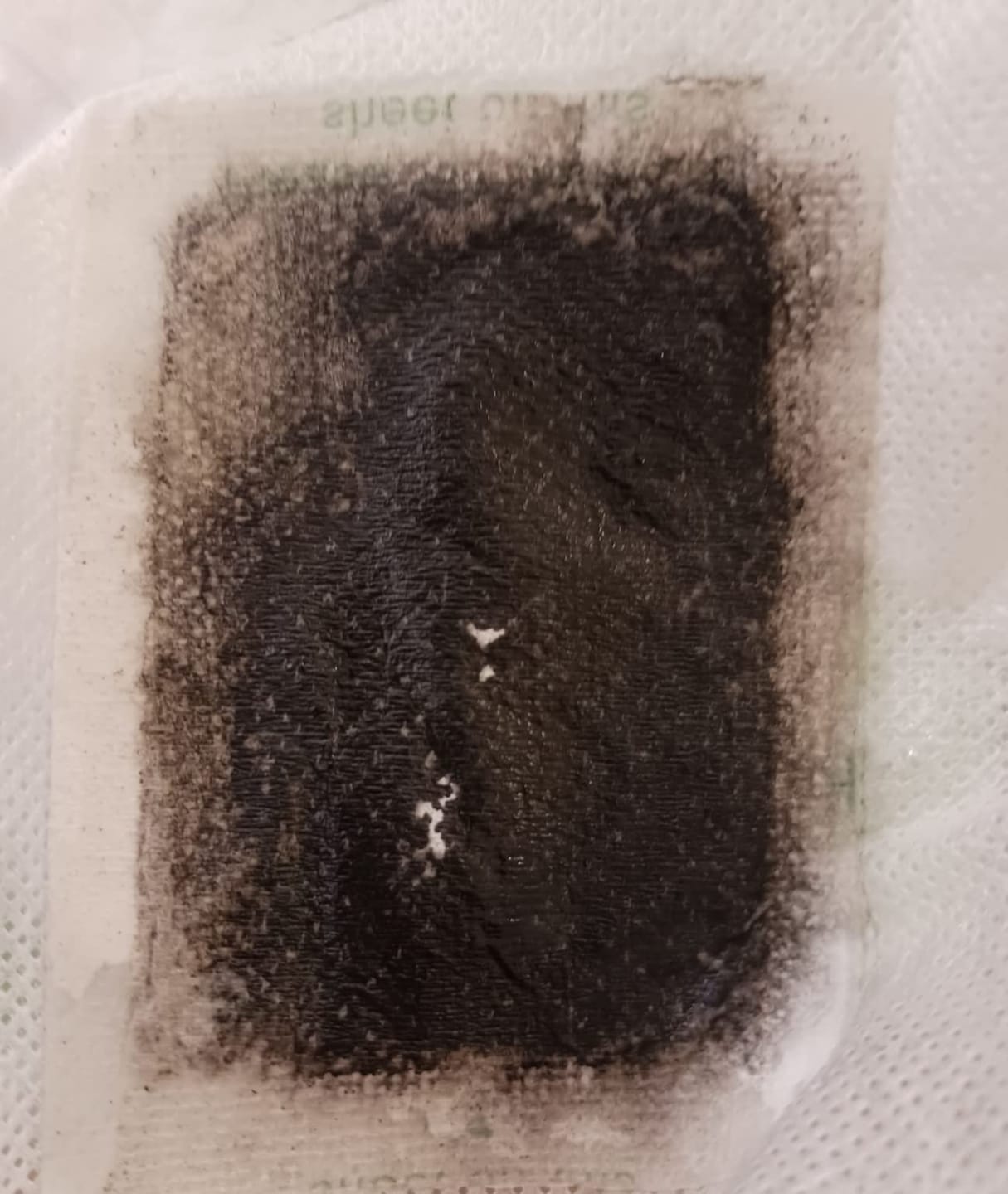 Customer photo review of DetoxiPad Éjszakai Méregtelenítő Tapasz