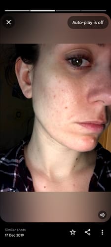 Customer photo review of Turmeric Glow Soap