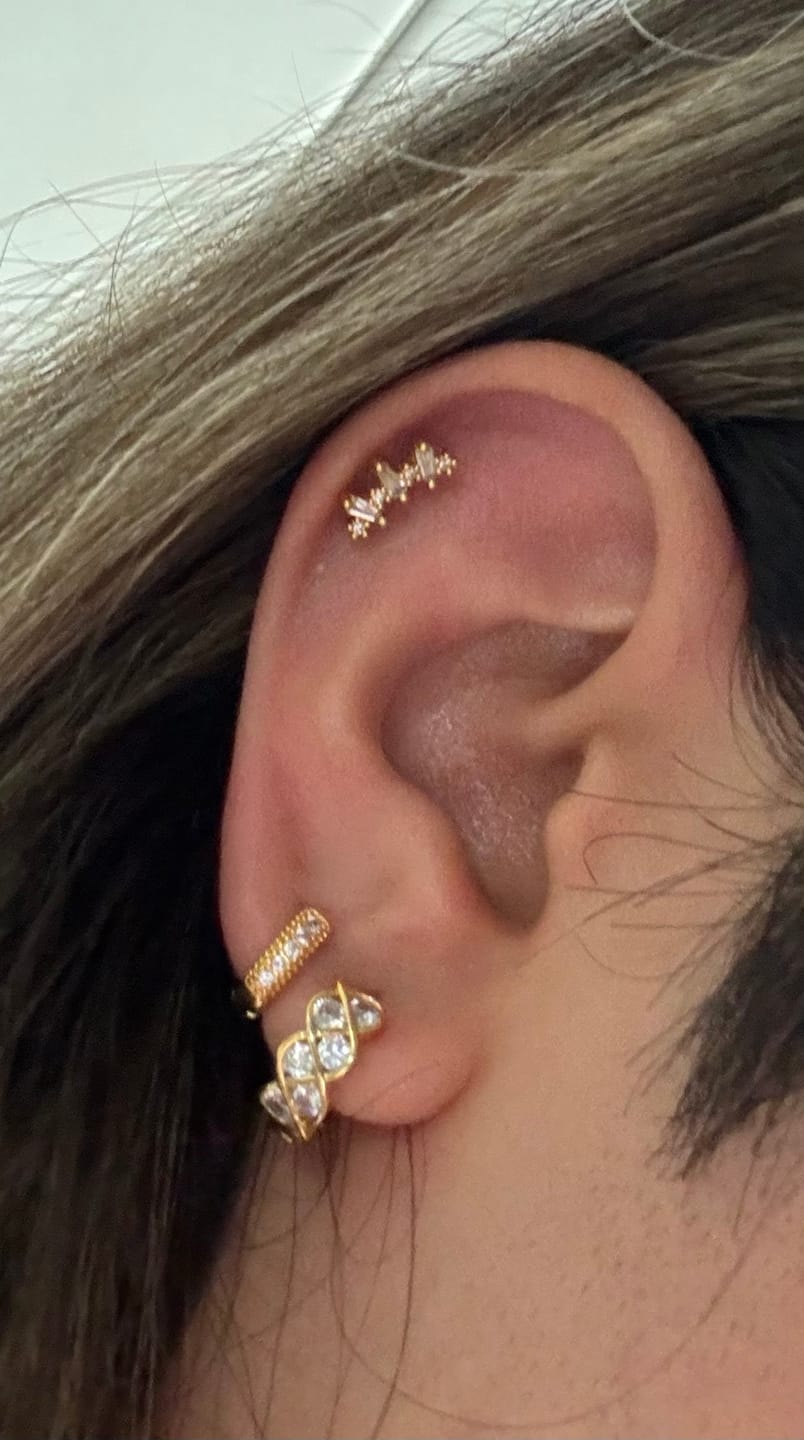 Customer photo review of Acero Quirúrgico Dorado Con Zirconias Primera Perforación