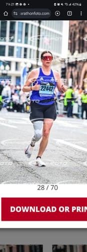 Customer photo review of Compression Sleeves V2 for Knees and Legs