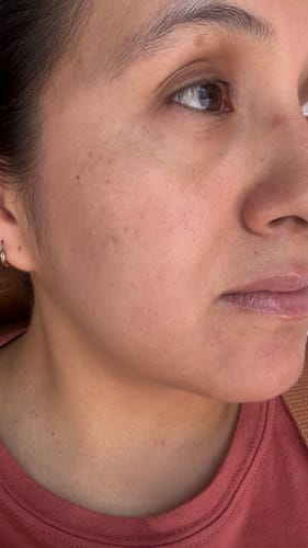 Customer photo review of Seyoul™ Suero 21 Días - H01