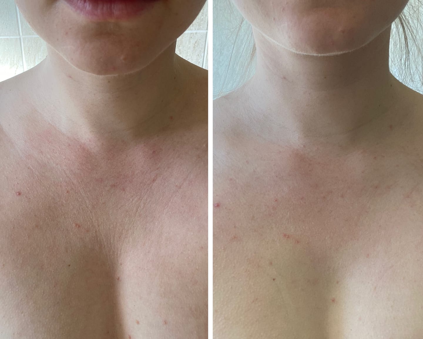 Customer photo review of Decolleté Pad mit Vitamin C