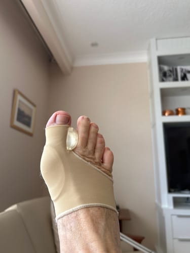 Customer photo review of Treatmedy™ Orthopedic Daytime Bunion Sleeve