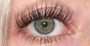 Customer photo review of Enhance® - Eyelash Growth Serum