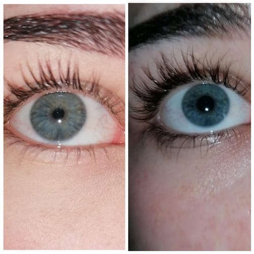 Customer photo review of Enhance® - Eyelash Growth Serum