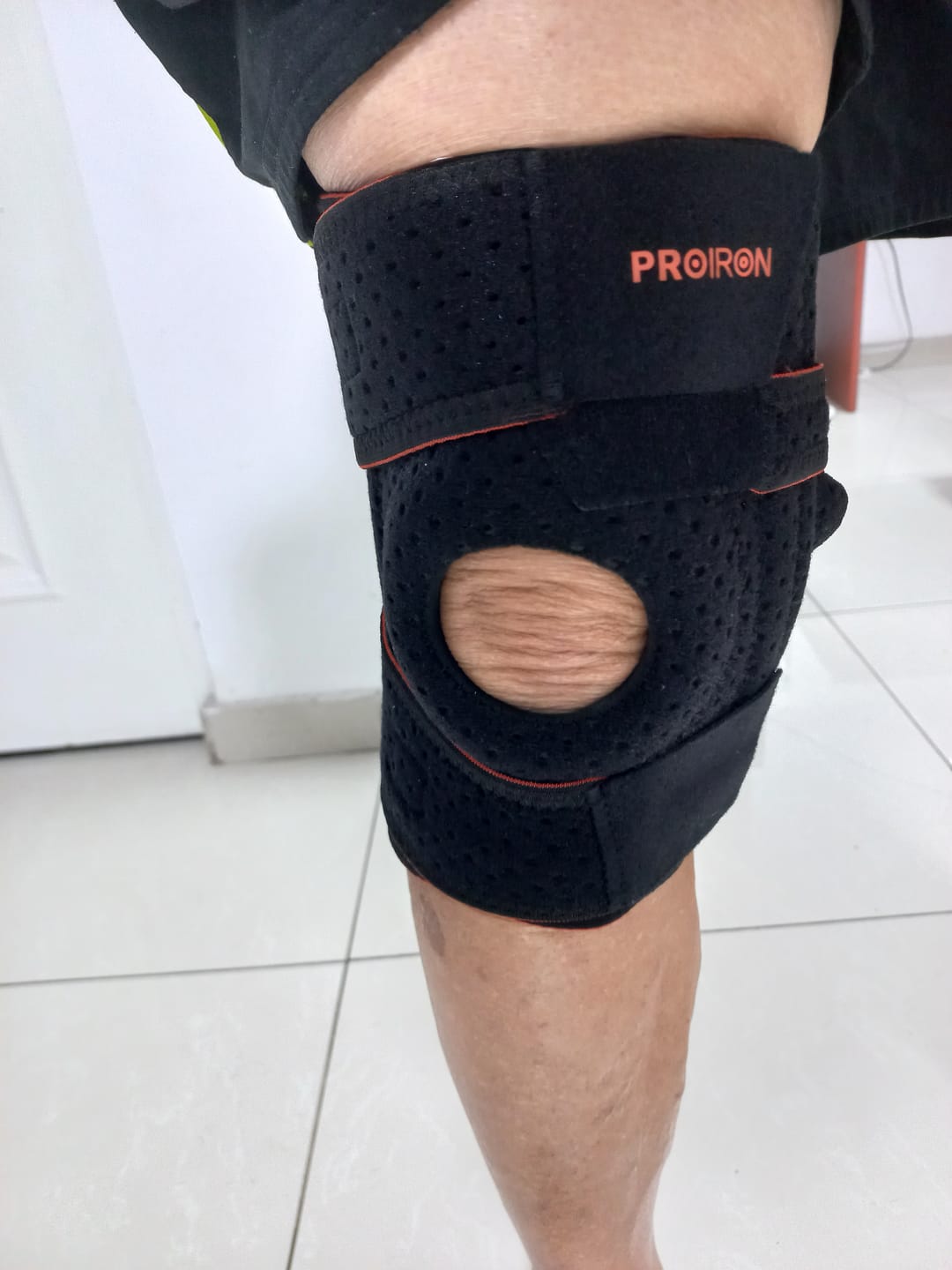 Customer photo review of Rodillera de Compresión Abierta