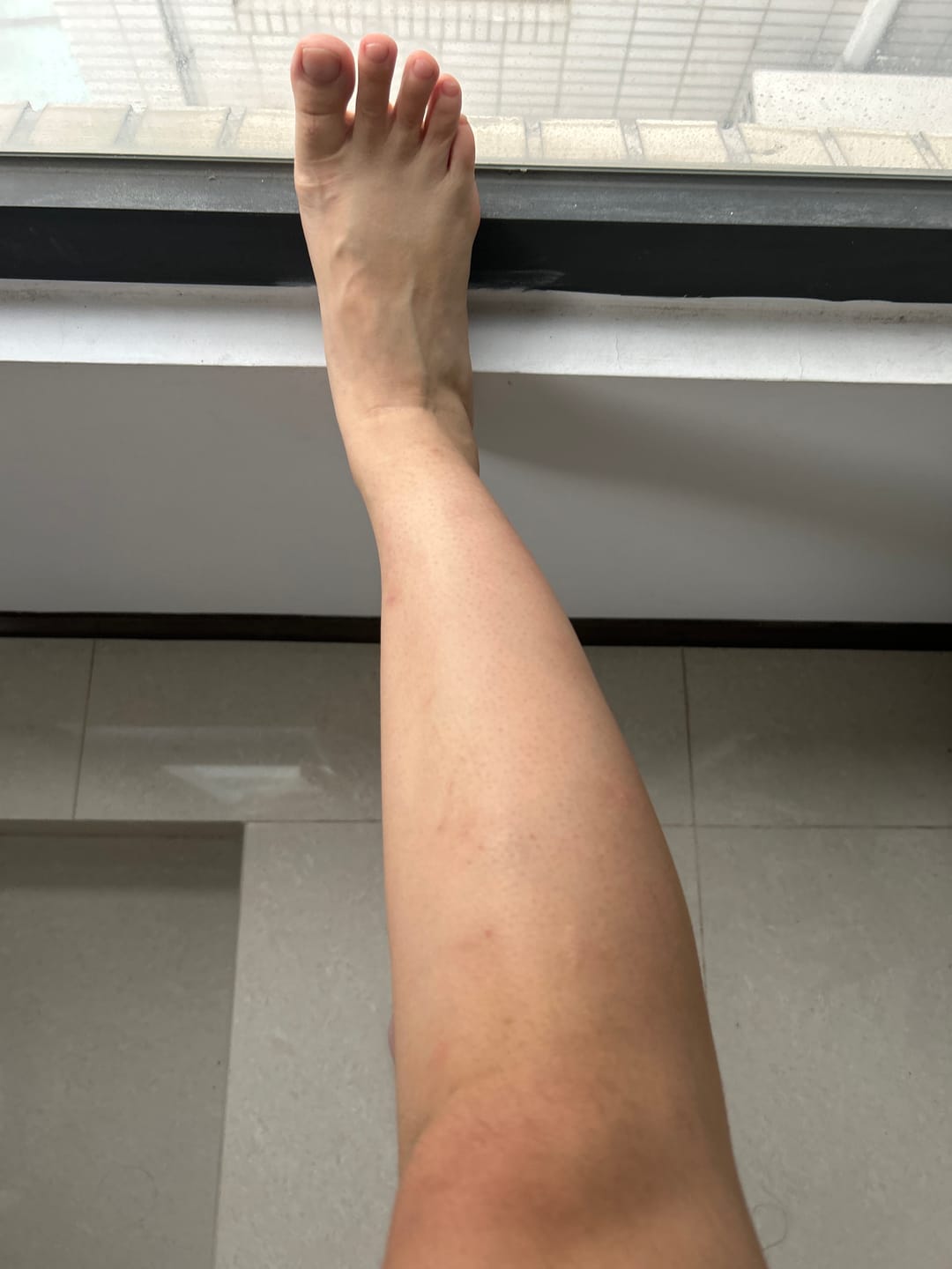 Customer photo review of Ulike Air10家用除毛儀