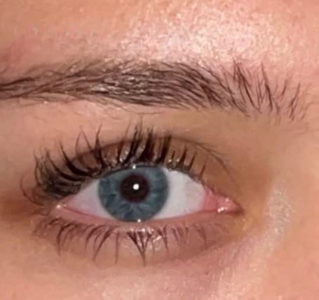 Customer photo review of Enhance® - Eyelash Growth Serum