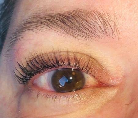 Customer photo review of Enhance® - Eyelash Growth Serum