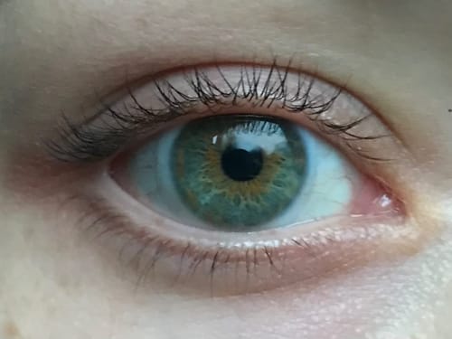 Customer photo review of Enhance® - Eyelash Growth Serum