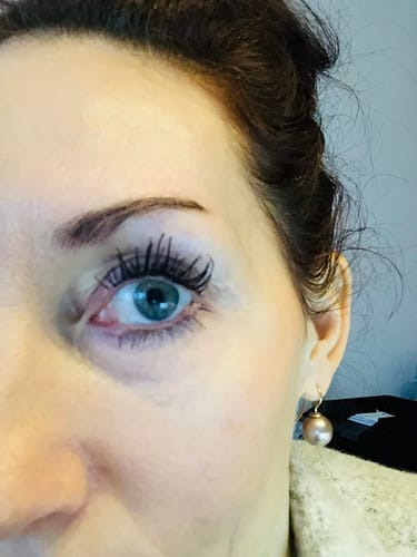 Customer photo review of Enhance® - Eyelash Growth Serum