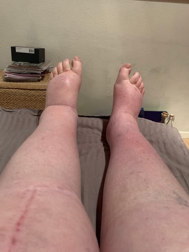 Customer photo review of Støttestrømper