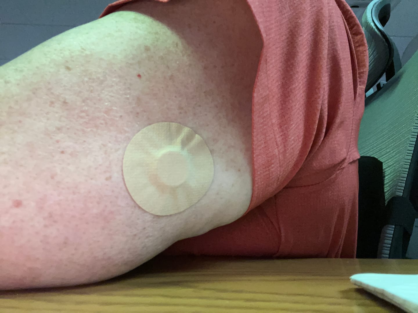 Customer photo review of Skin Grip MAX Freestyle Libre 3 Patches - 10 Pack