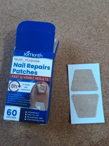 Customer photo review of Anti-Fungal Serum