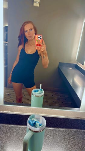 Customer photo review of WrinkleFix: Unlimited Toxins Membership