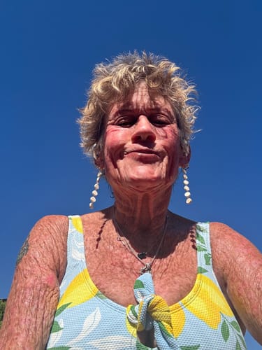 Customer photo review of Self Tanning 150 Capsules - ALMOST SOLD OUT