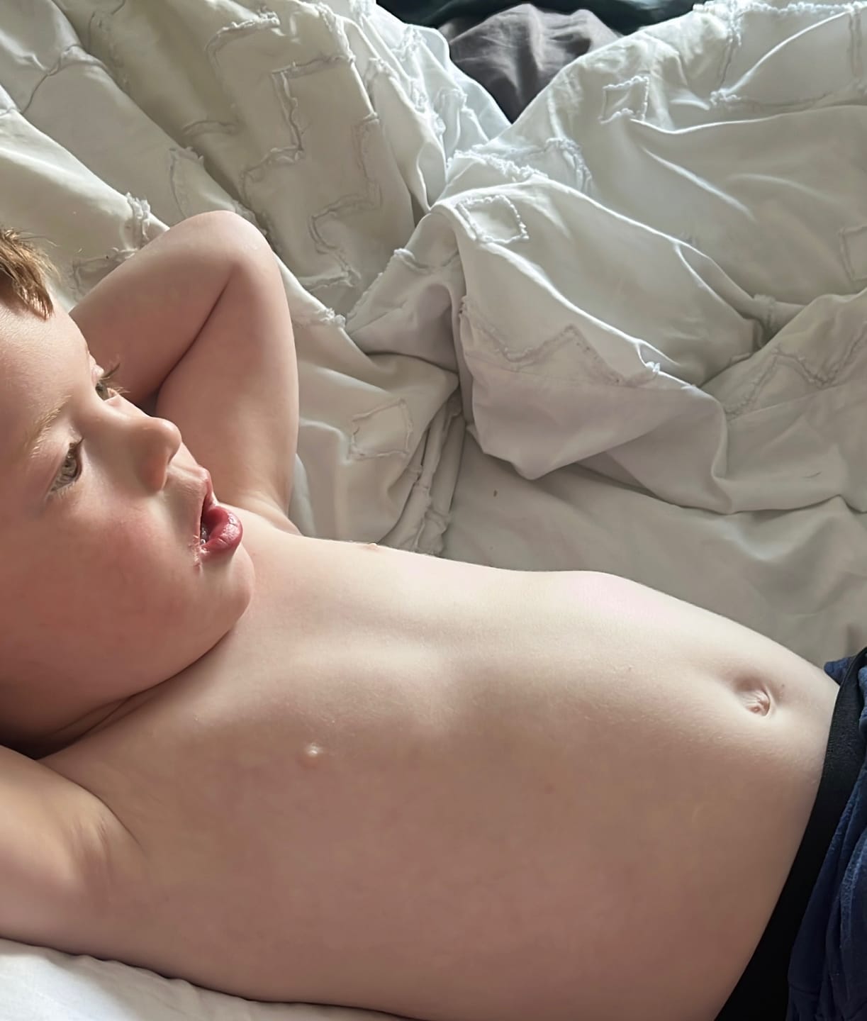 Customer photo review of Bioskin Junior Duo Pack