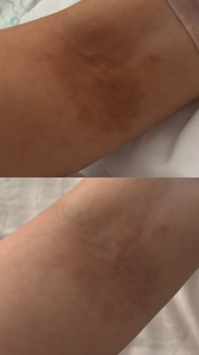 Customer photo review of Vivier Advanced Skin Lightening Serum