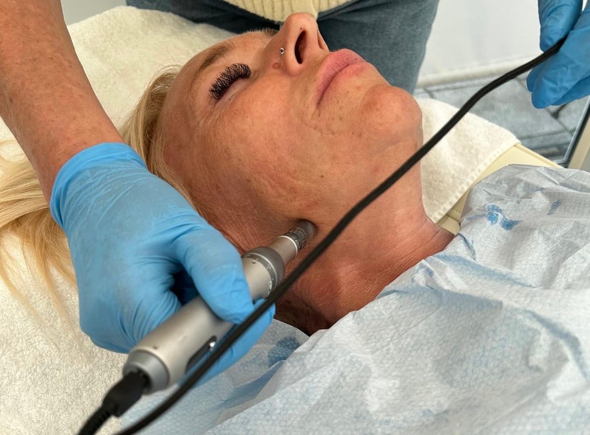 Customer photo review of Genuine Dr Pen Microneedling Cartridges (10 Pack)
