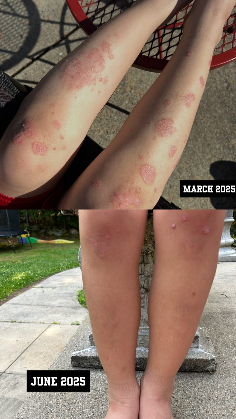 Customer photo review of Body Biome Kit