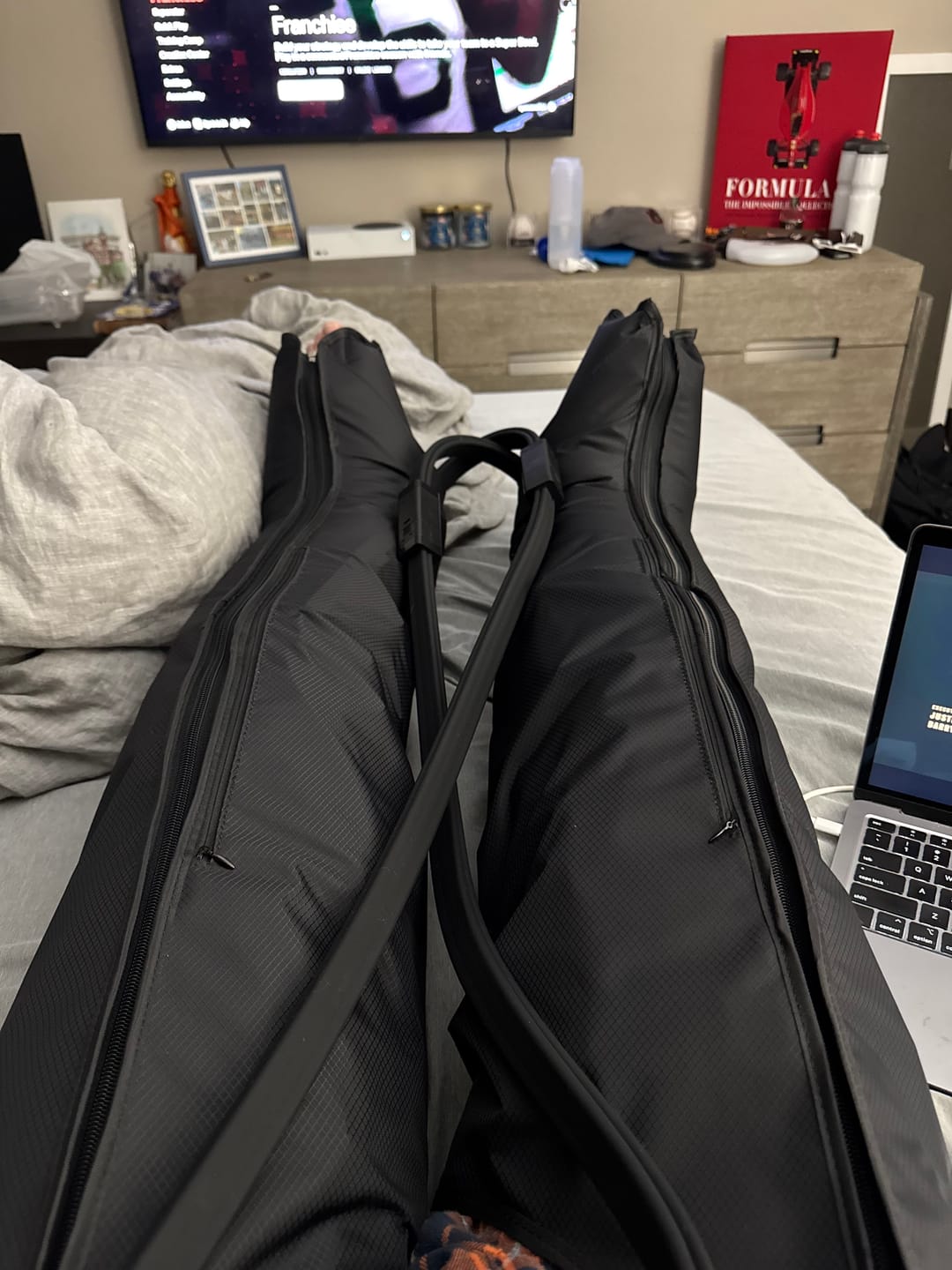 Customer photo review of Leg Compression Sleeves