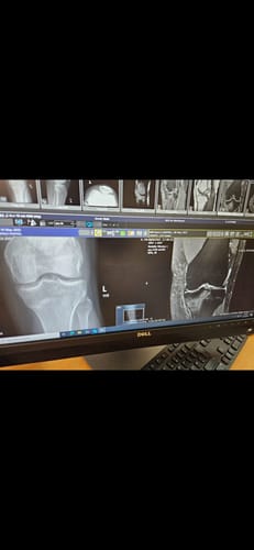 Customer photo review of Savings Bundle