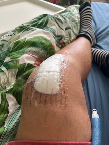 Customer photo review of RevitaLife Knee Sleeve Elite