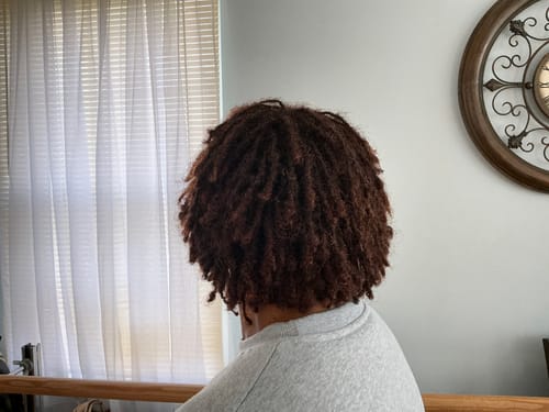 Customer photo review of Scalp & Skin Rebuilder 4oz (3 Flavors)