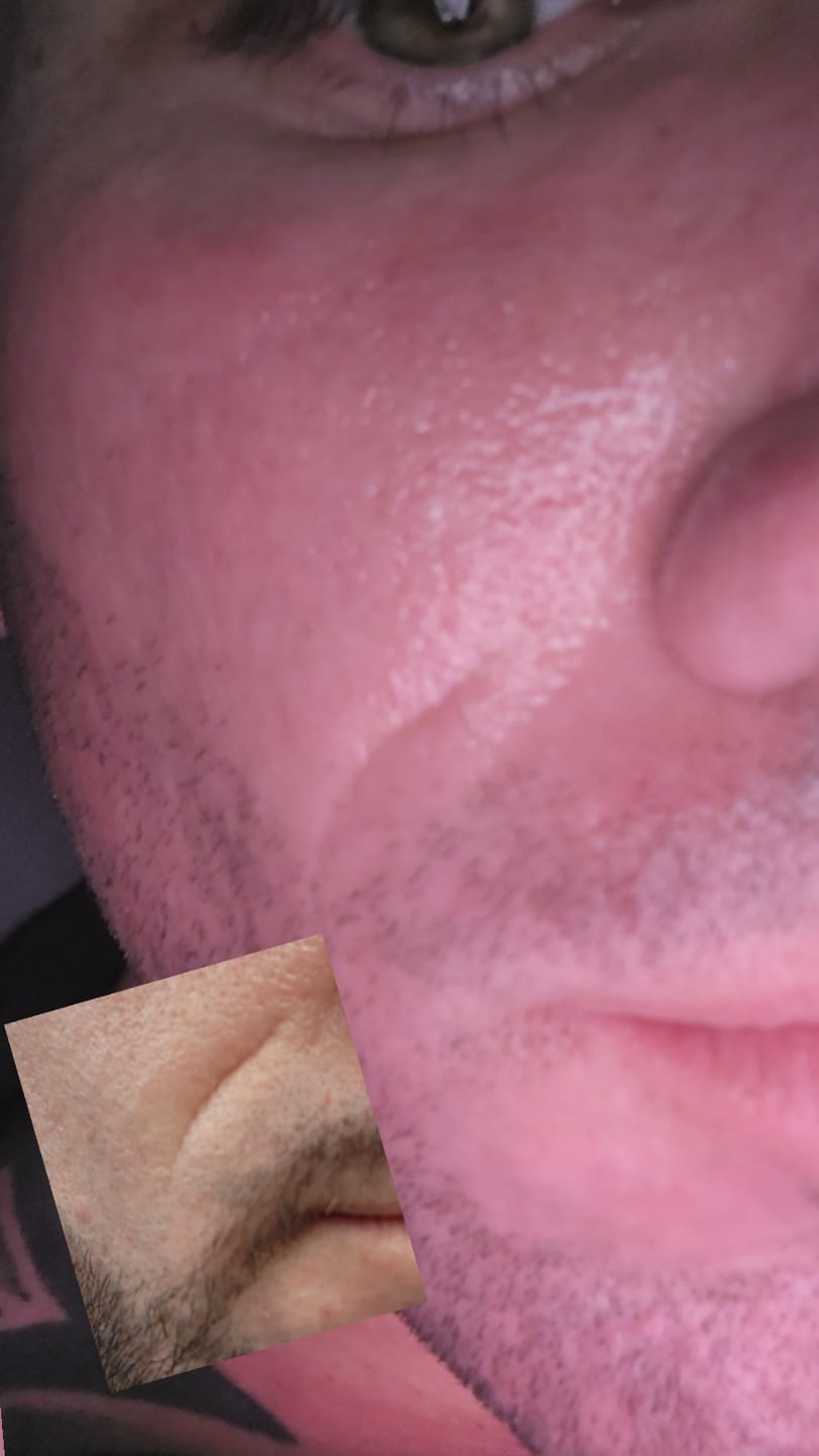 Customer photo review of Glov Anti-Aging Serum (5ml)