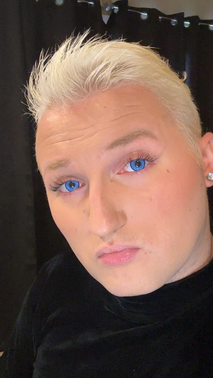 Customer photo review of Amaretto Blue Prescription Colored Contact Lenses