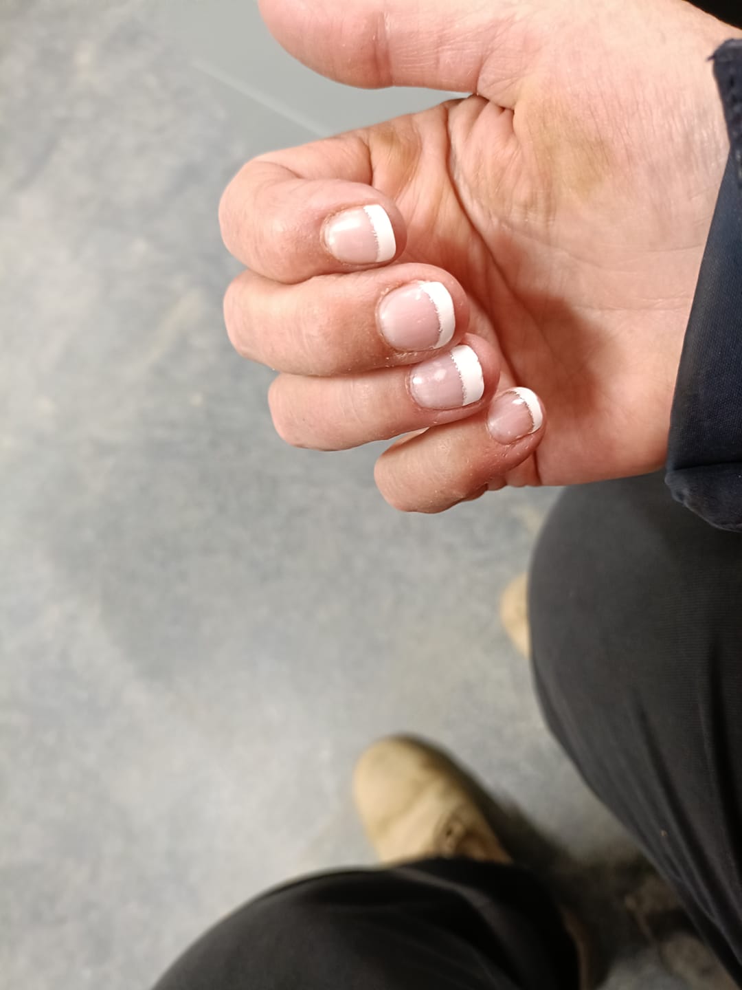 Customer photo review of White French Tip Glitter DIY Semicured Gel Nail Sticker Kit