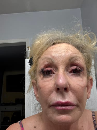 Customer photo review of Cosplay Pink love Pink Colored Contact Lenses