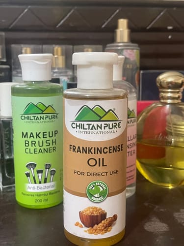 Customer photo review of Frankincense Oil – Works well to tighten the skin, reduces wrinkles, Improves appearance of skin 100% pure organic [Infused] 250ml