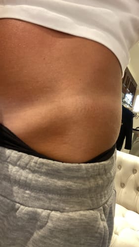 Customer photo review of Intensive Tanning Balm