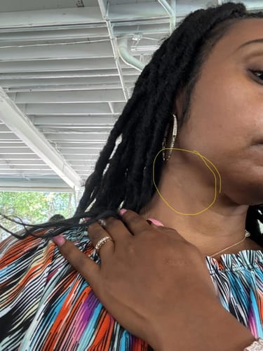 Customer photo review of Nuvex™️ Anti Cellulite Massage Oil