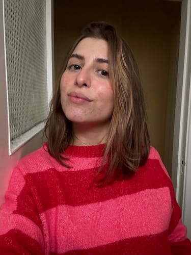 Customer photo review of The Complete Acne Stopper Starter Pack