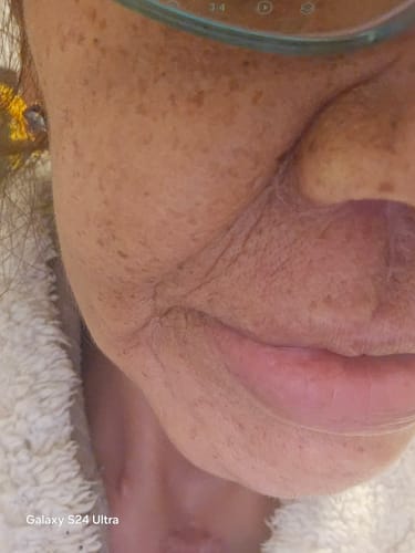 Customer photo review of Varita Infinite Glow & Serum Activador