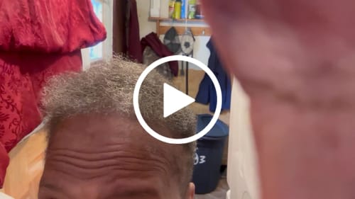 Customer video review of Rennora EXTRA-Strength Hair Growth Serum