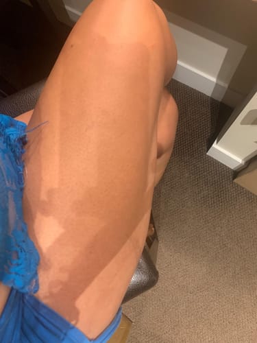 Customer photo review of Nuvex™️ Anti Cellulite Massage Oil