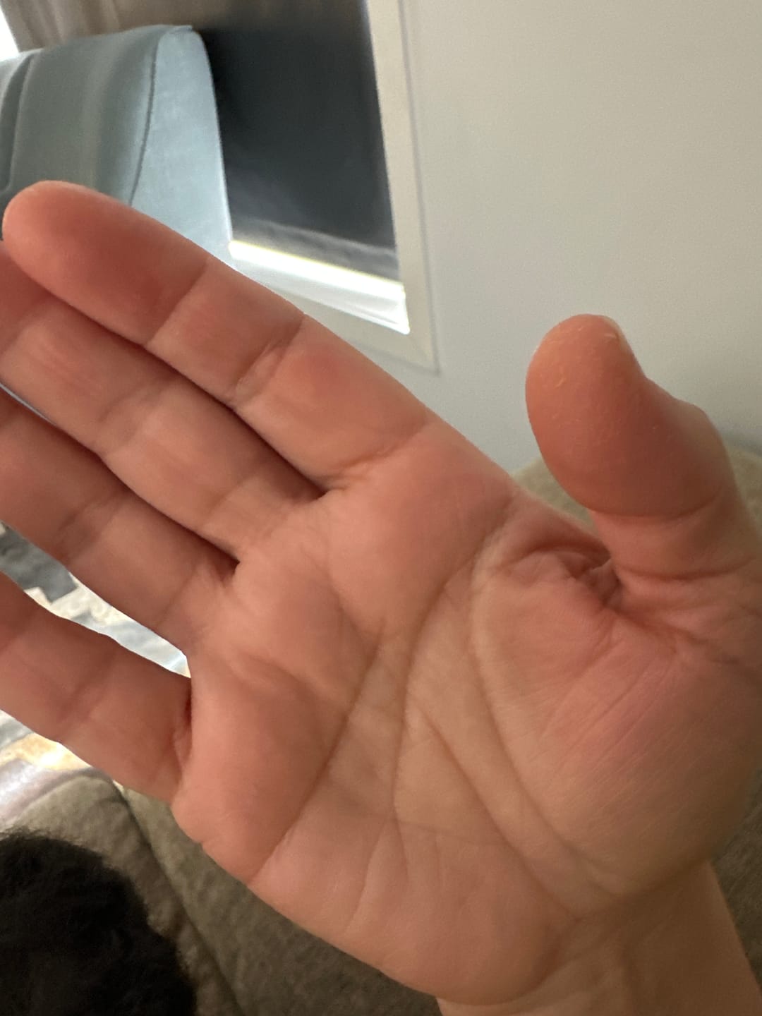 Customer photo review of Baby Bum Balm