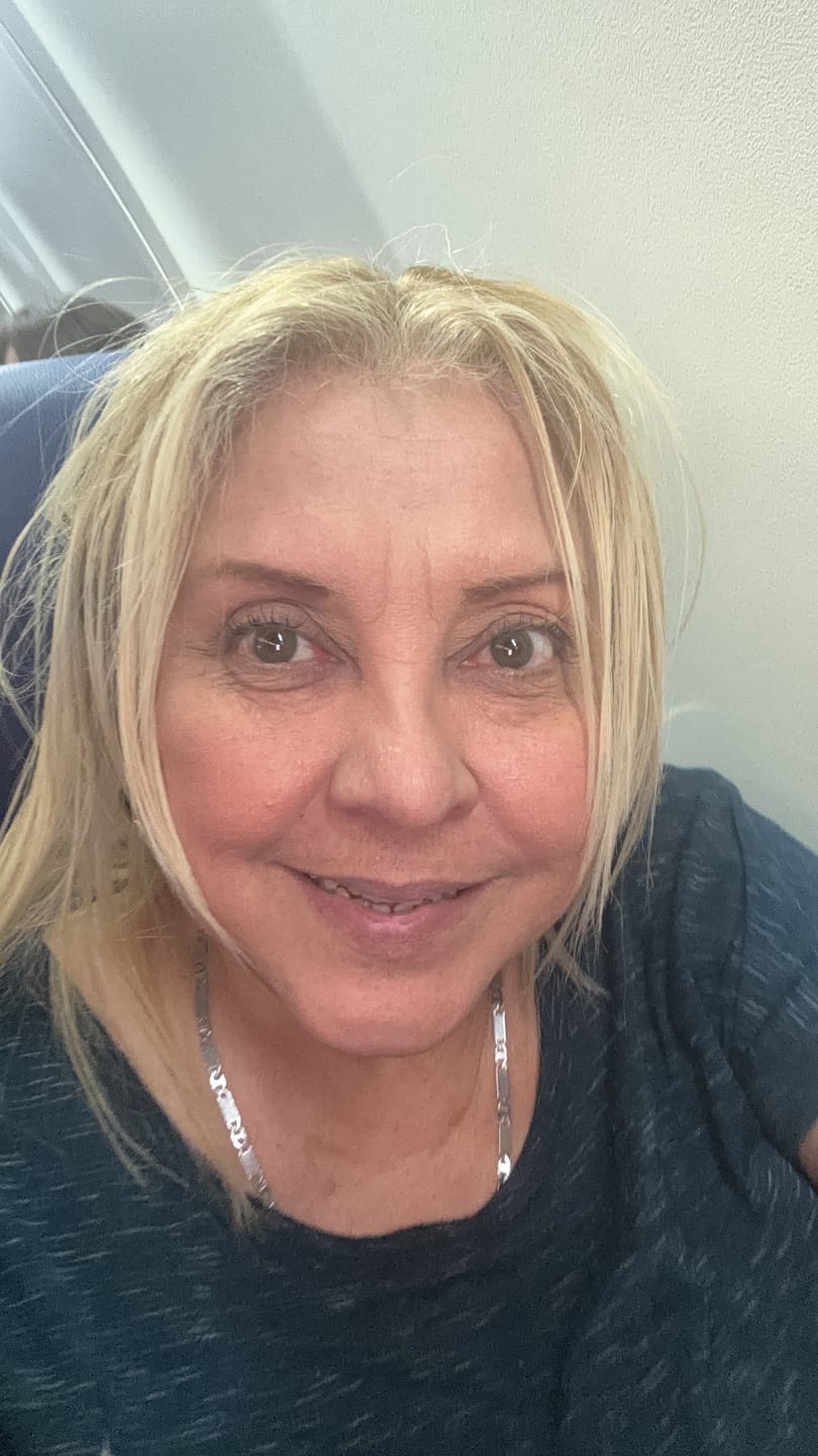 Customer photo review of Flora Green Prescription Colored Contact Lenses