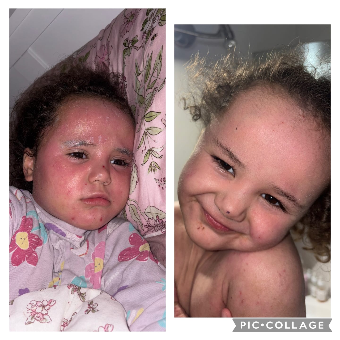 Customer photo review of Skin Hydration Duo - Kawakawa Balm + Kawakawa Oil
