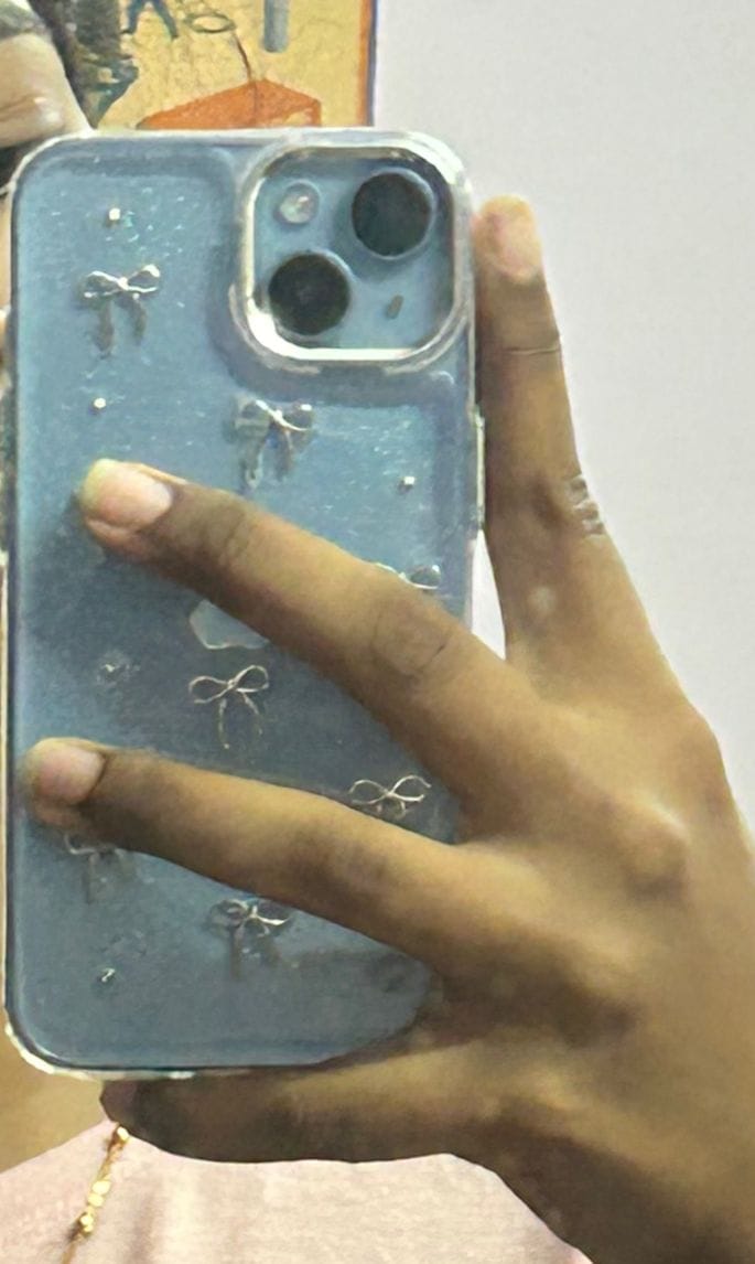 Customer photo review of 3D Glitter Silver Bow Transparent iPhone Case