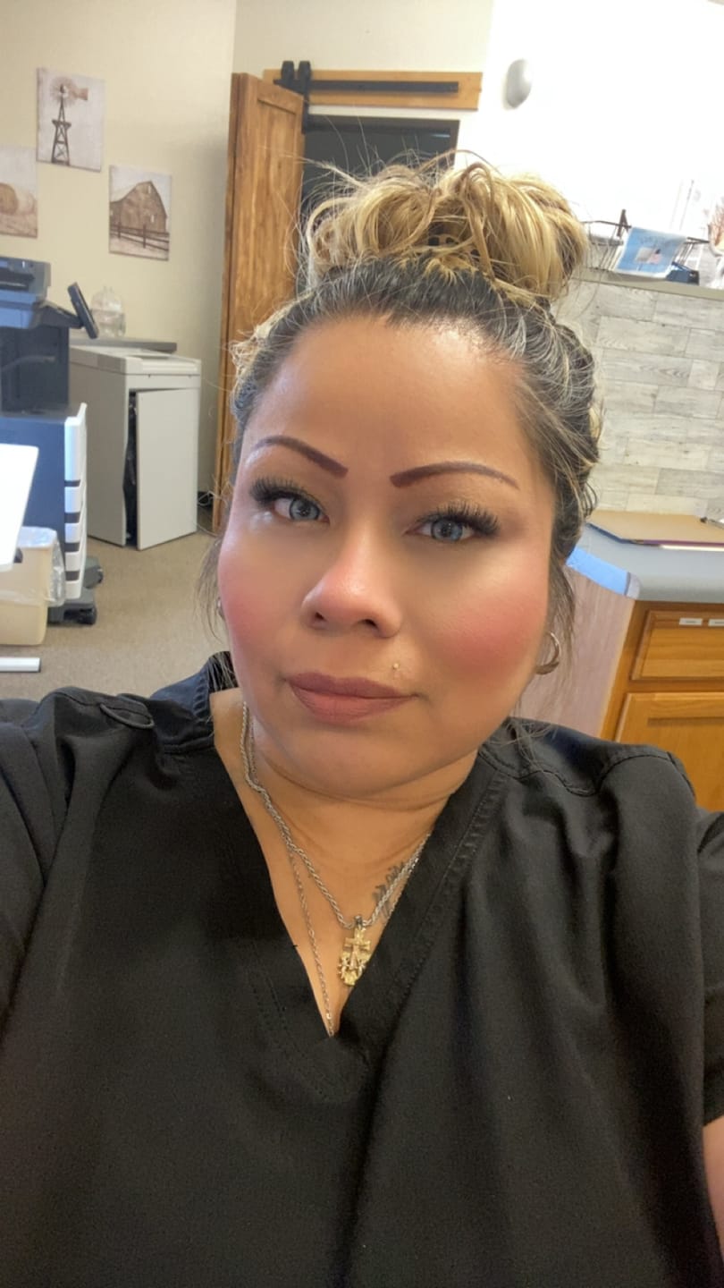 Customer photo review of Pixie Blue Prescription Coloured Contact Lenses