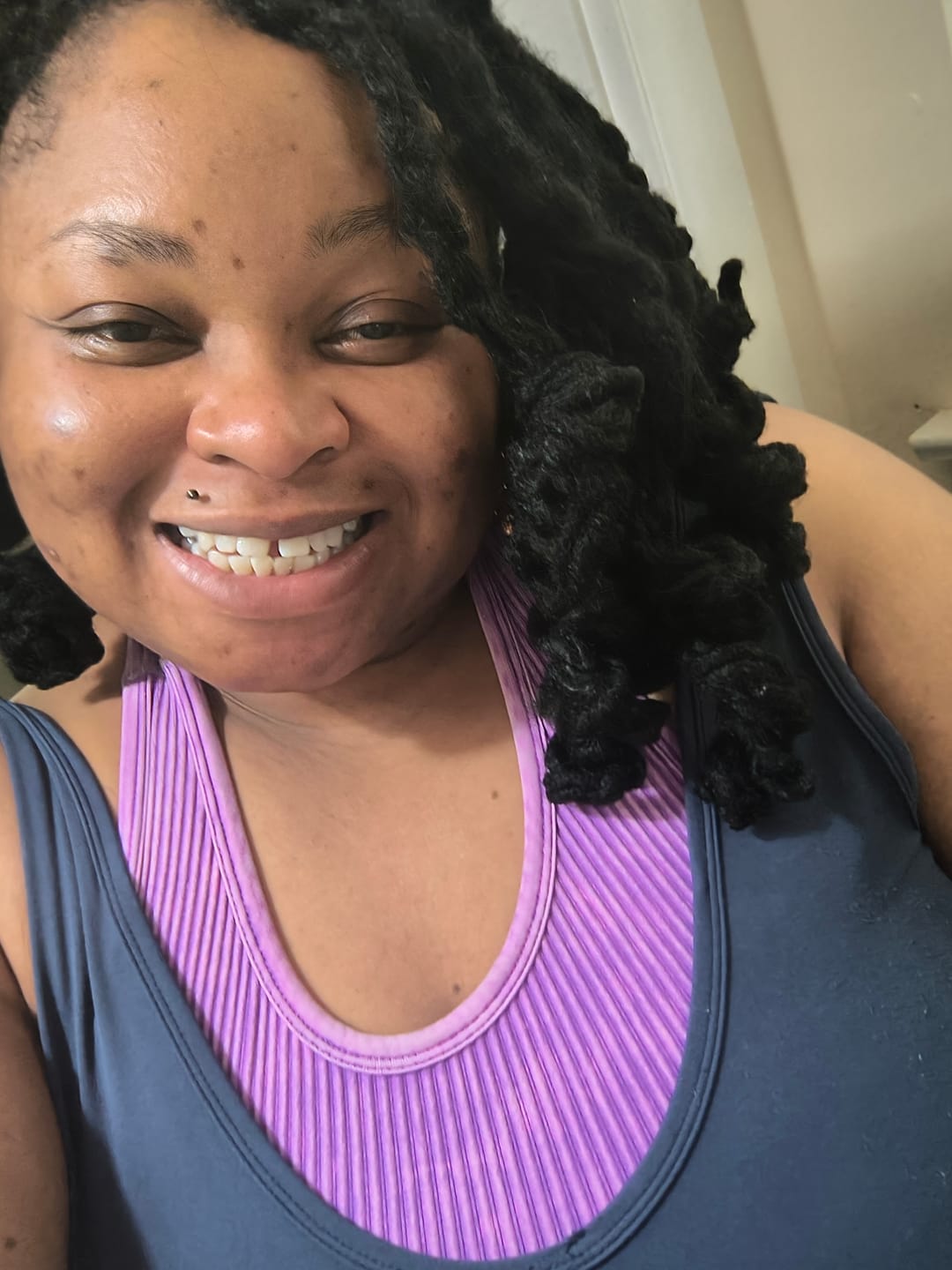 Customer photo review of Magical Soap