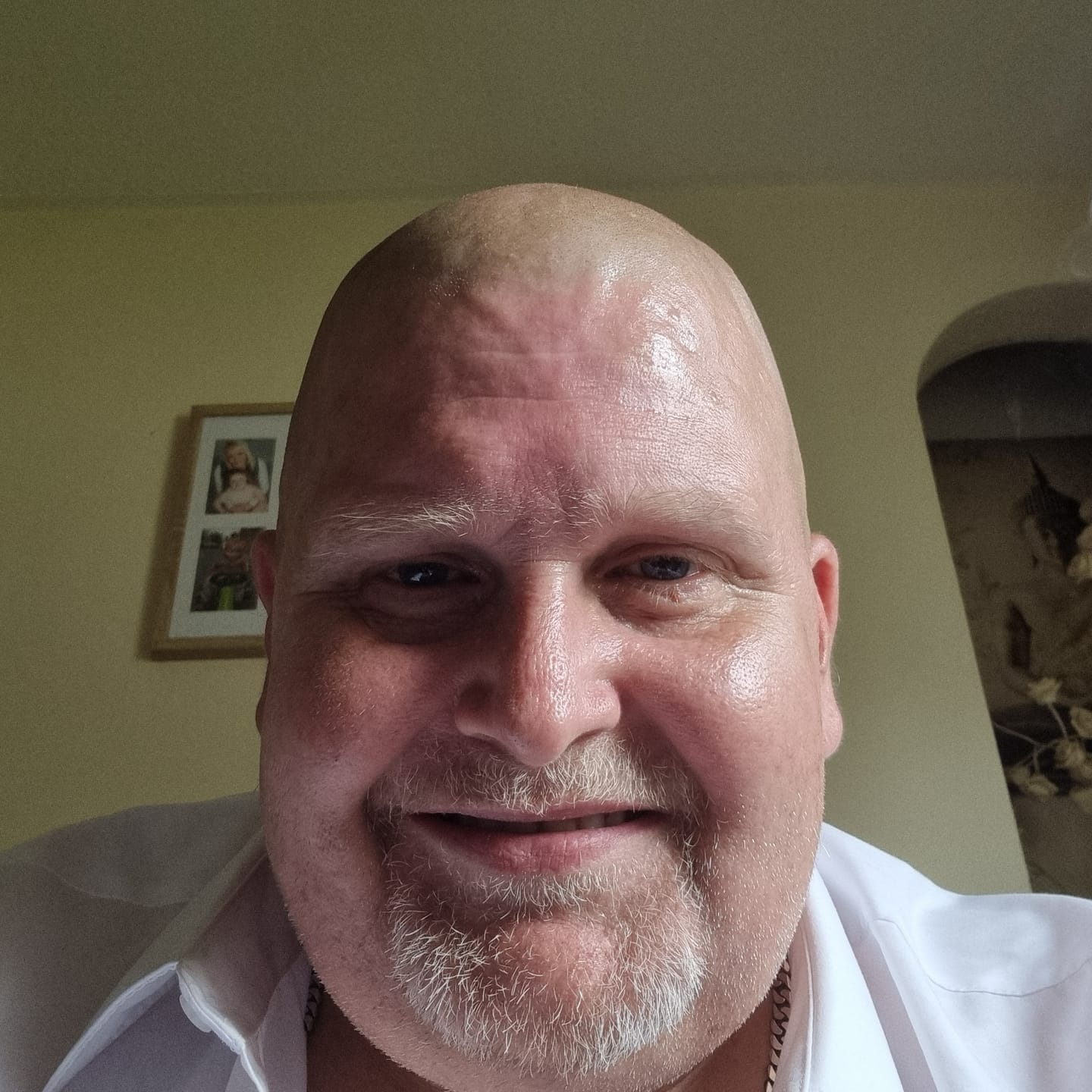 Customer photo review of Trimpod 3.0: The Ultimate Shaver for Bald Men